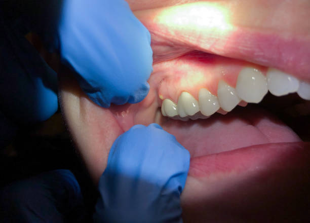 Best Urgent Tooth Repair  in Liverpool, NY